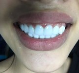 Nha Khoa Thiện Mỹ Nha Trang